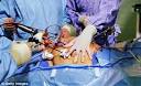 Fake doctor performs liposuction on a woman while smoking a cigar