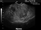 MEDISON.RU: <b>Myoma</b>