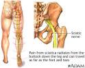 Sciatic nerve: MedlinePlus Medical Encyclopedia Image