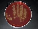 A bad germ gets worse - Health - Health care - msnbc.