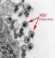 HIV (Human Immunodeficiency Virus) | About Health