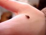 Bed Bug Bites, Rashes &amp; Symptoms