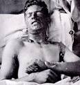 Remembering mustard gas « The Write Note