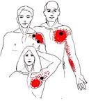 and <b>chest pain</b> of this