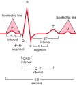 electrocardiogram - definition of electrocardiogram in the Medical ...