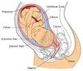 sacculo pronunciation