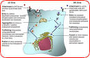Comparison of <b>BK Virus</b> and JC