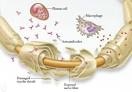 GAMUNEX-C Causes of <b>Chronic Inflammatory Demyelinating</b>