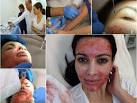 KIm Kardashian Vampire Facial Scary Or Awesome? (PHOTO) - dBTechno