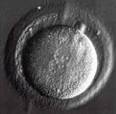 Fertilization - Fertilized Eggs from In Vitro Fertilization, IVF