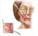 the zygomaticus muscles,