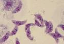 <b>Toxoplasma</b>