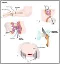 Amputation - procedure, test, blood, removal, pain, complications ...