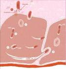 oral <b>Listeria infection</b>.
