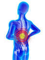 <b>back injuries</b> negative ions