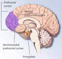 File:Ptsd- brain .png - Wikipedia, the free encyclopedia
