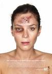 Anna Friel