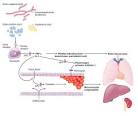<b>Sepsis</b> leads to organ failure