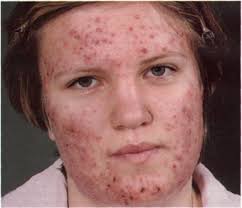 images?q=tbn:ANd9GcSwf-NsjhzFENGznVdr2XM4iJQaLH8P8bSOzcYO2V9_uBTwOmEFsdAaGU9HGA