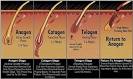 Image dht hair loss Blocks DHT Picture