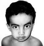 Definition of «<b>Facies</b>»