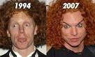 Celebrities Who Had The Worst Luck In Cosmetic Surgery It Thing