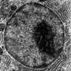nucleolo