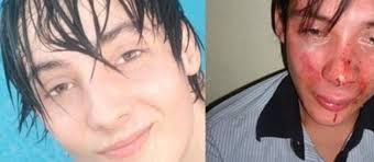Revoltado, jovem espancado ap&oacute;s beijar homem em boate vai &agrave; ...