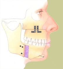 http://t2.gstatic.com/images?q=tbn:ANd9GcT33b5WydnecWlWoYxpBo8D72rHOvtCB5uZUBS8WuL0xz4UlHofvw