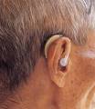 Causes of Hearing Impairment