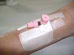 File:Placement of intravenous cannula 3.jpg - Wikipedia, the free ...