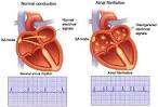 CatheterForceSensing < Haptics < TWiki