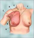 Image - Axillary Lymph Nodes