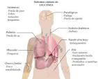 File:Sintomas de <b>leucemia</b>.png