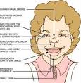 Williams Syndrome (also named