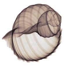 Xray image
