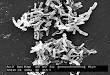 Clostridium - Wikipedia, the free encyclopedia
