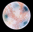 Lower Respiratory Tract Infections