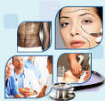 Incisional Hernia