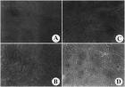ScienceDirect.com - Cancer Letters - Heme oxygenase-1 expression ...