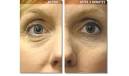 Before & After photos
