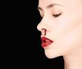 Bloody Nose   Ailments   The Wellness Directory NZ