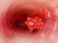 Deep vein <b>thrombosis</b>