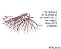 Anaerobic organism: MedlinePlus Medical Encyclopedia Image