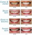 Cosmetic dental surgery | Dental Help