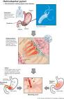 Press Release: The 2005 Nobel Prize in Physiology or Medicine