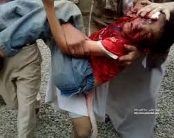 الى من لدية ضمير في اليمن ... هناك مأساة حقيقه في جامعه صنعاء .. والاعلام يضللكم ... اتقوا الله Images?q=tbn:ANd9GcTEu2cbohBYHRUo6aUOpzI3-eptEw7F9RmltUWrjYfrnPHiMpOF&t=1