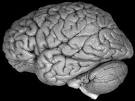 Brains On-