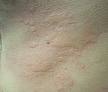 Learn and talk about Allergy, Effects of external causes, Immune ...