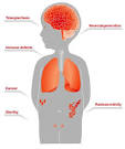 <b>Ataxia</b>